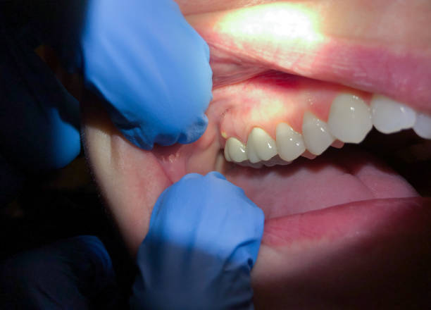 Best Broken Tooth Emergency  in Kohler, WI
